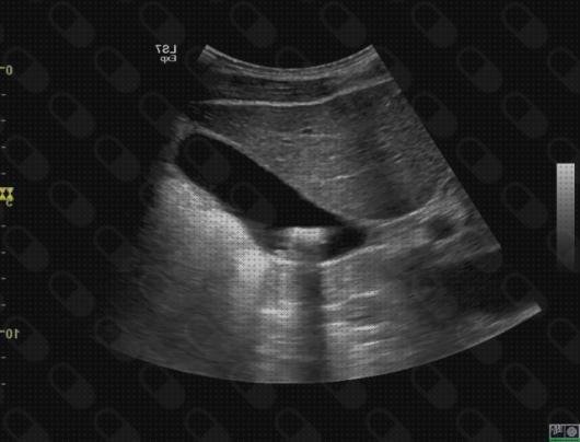 Las mejores 20 Ecografías Por Las Tardes En Palmas