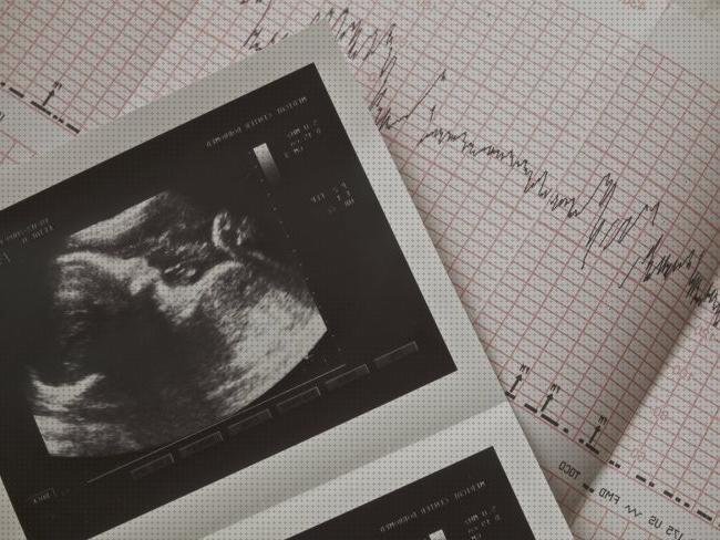 ¿Dónde poder comprar ecografía vaginal aparato Mas ecografía coneja ecografías ecografías vaginales meses de embarazo?