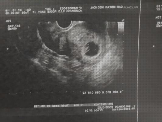 Las mejores marcas de ecografía vaginal aparato Mas ecografía coneja ecografías ecografías vaginales meses de embarazo