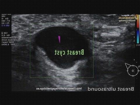 ¿Dónde poder comprar ecografista ecografista de diagnosiss médico?