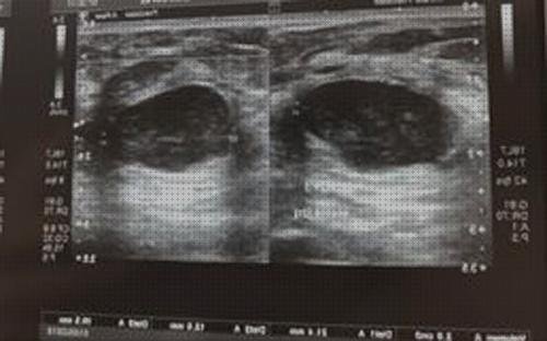 Las mejores ecografista ecografista de diagnosiss médico