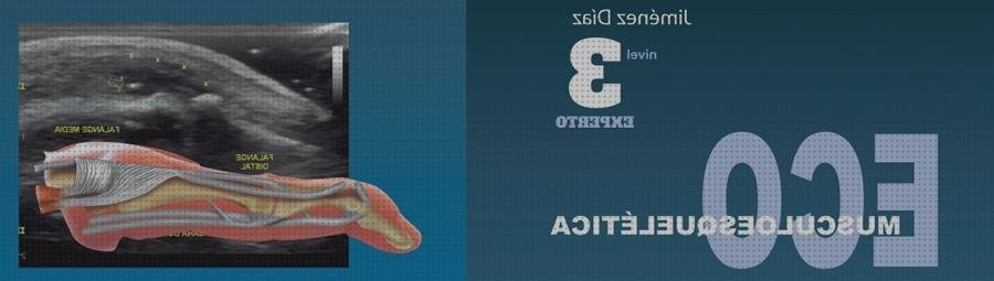 Las mejores marcas de ecografista ecografista musculoesqueletico nivel