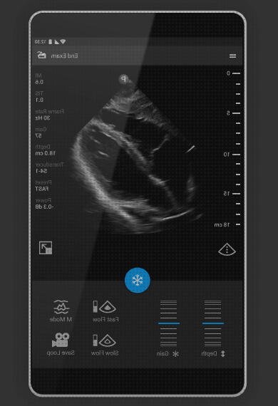 Review de los 17 mejores ecografista olbia