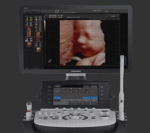 Review de los 17 mejores ecografo 5 d