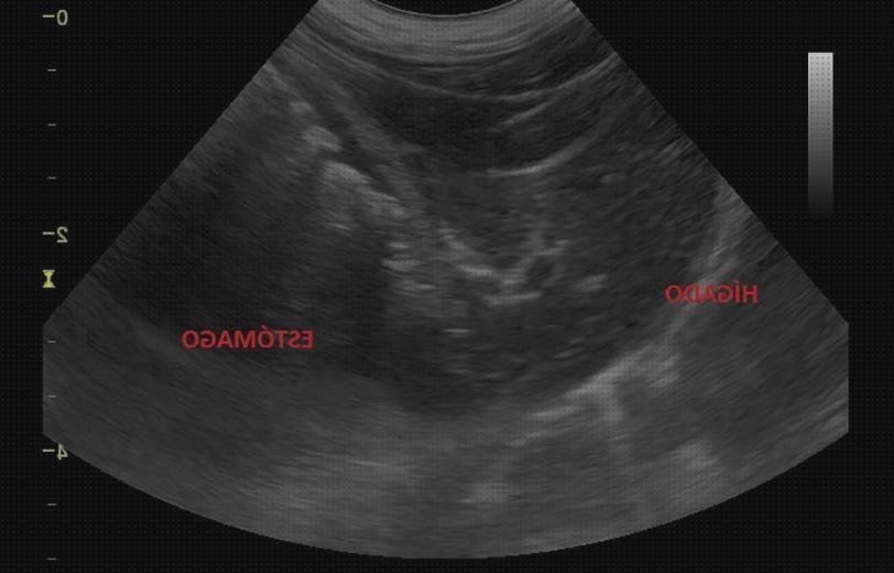 Las mejores marcas de ecografos ecografo a estomacal canina