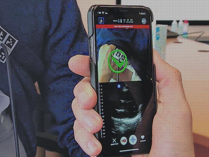Las mejores movil ecografo de bolsillo wifi movil