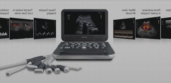 ¿Dónde poder comprar ecografos doppler ecografo doppler potencia ele?