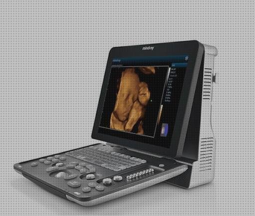 Review de los 18 mejores ecografo duplex para comprar