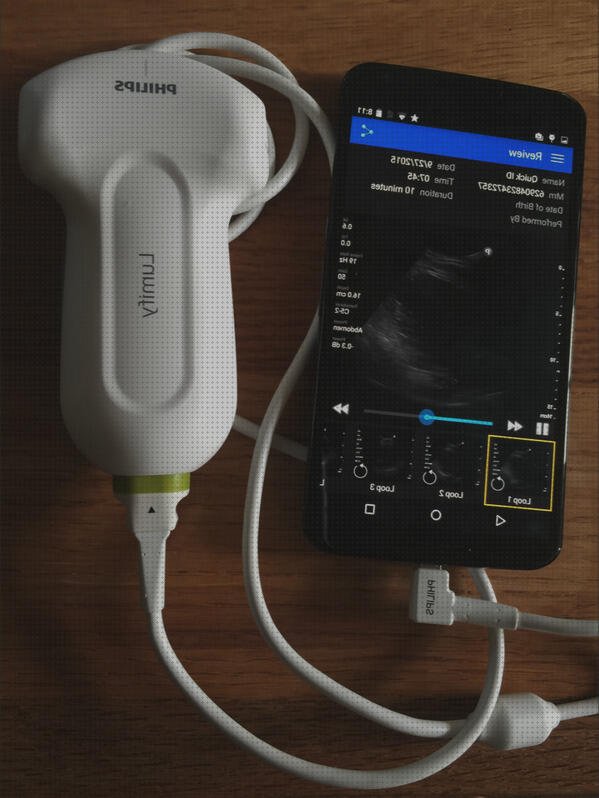 ¿Dónde poder comprar ecografo philips ecografo ecografo lumify philips prezzo?
