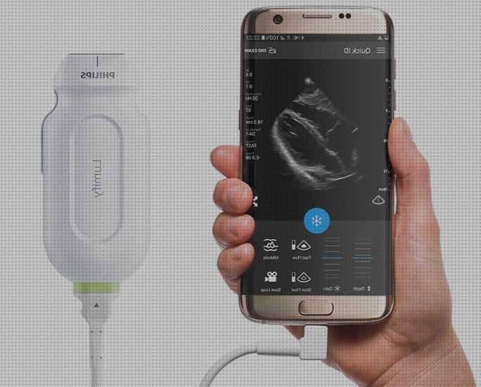 Las mejores marcas de ecografo philips ecografo ecografo lumify philips prezzo