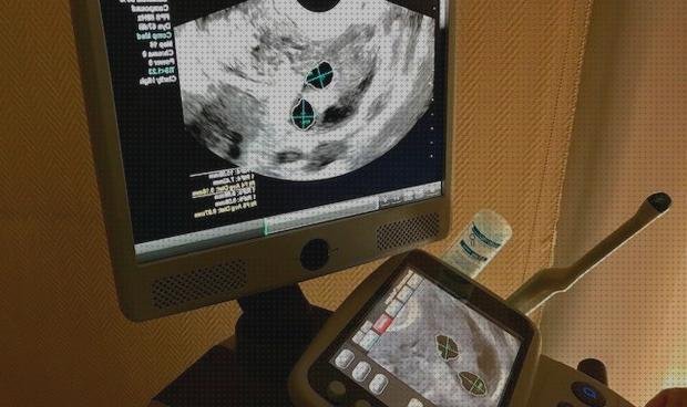 Las mejores medicine ecografos ecografo medicina interna