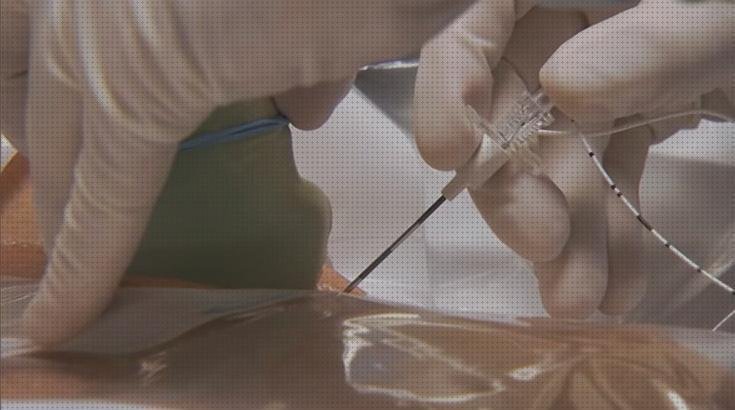 TOP 6 ecografo needle guidance