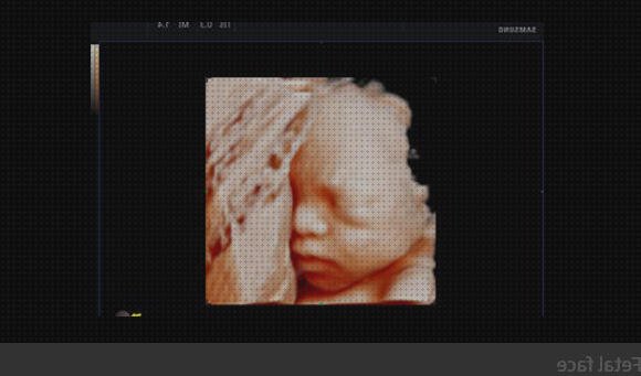 Análisis de los 11 mejores ecografo orientaciones para comprar