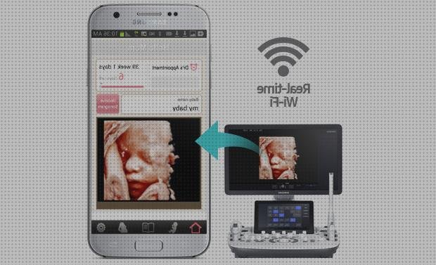 Las mejores movil ecografo para movil baby