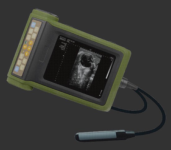 Las mejores marcas de Mas compensador de alejamiento ecografo Mas ecografo portátil comprar abdominal Mas ecografo schippers ecografo porcino en ejea de los caballeros