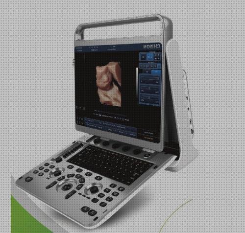 Los mejores 7 Ecógrafo Portátiles 3d