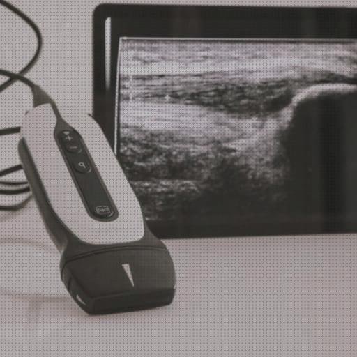 Los mejores 13 Ecografo Portátiles Diseños Electronicas