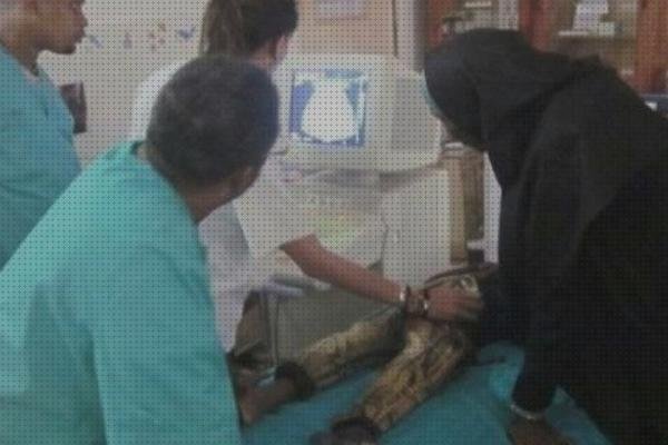 Los 18 Mejores ecografo profesionales del mundo