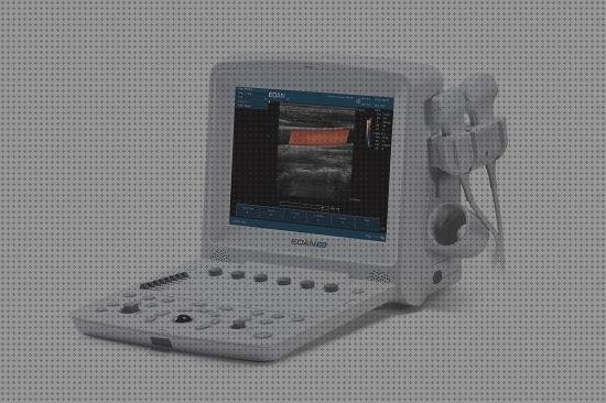 Las mejores smartphone ecografo smartphone barato