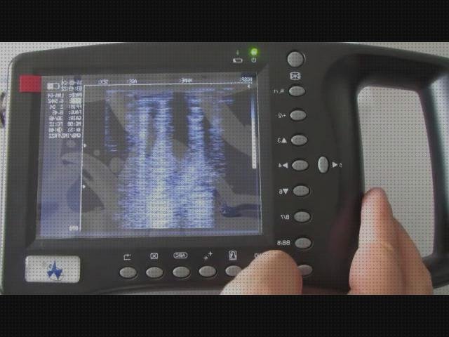 Review de ecografo wed 3100