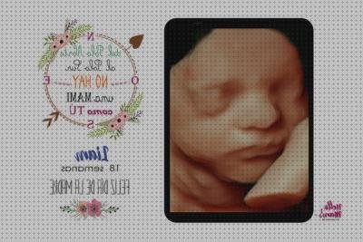 ¿Dónde poder comprar fonendoscopio 86 euros Mas esterilizacion fonendoscopio Mas termómetro thermoval ecografoas por 25 euros?