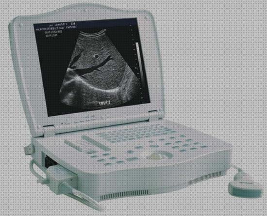 Las mejores marcas de ecografos ecografo tipo laptop