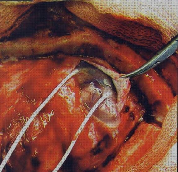 Las mejores marcas de ecografos ecografos minards