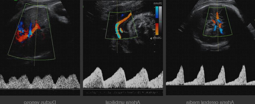¿Dónde poder comprar fetal doppler eco doppler anemia fetal?