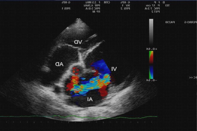 ¿Dónde poder comprar ecos doppler eco doppler técnica?