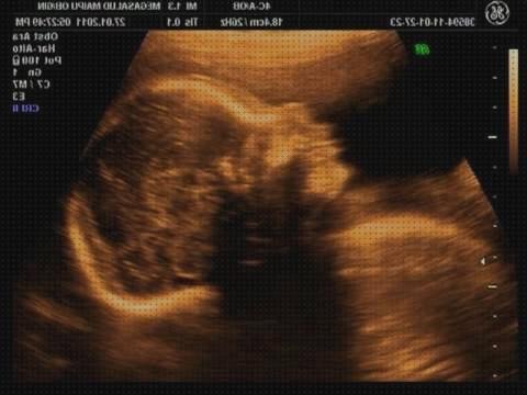 ¿Dónde poder comprar obstetrica eco doppler obstetrica precio?