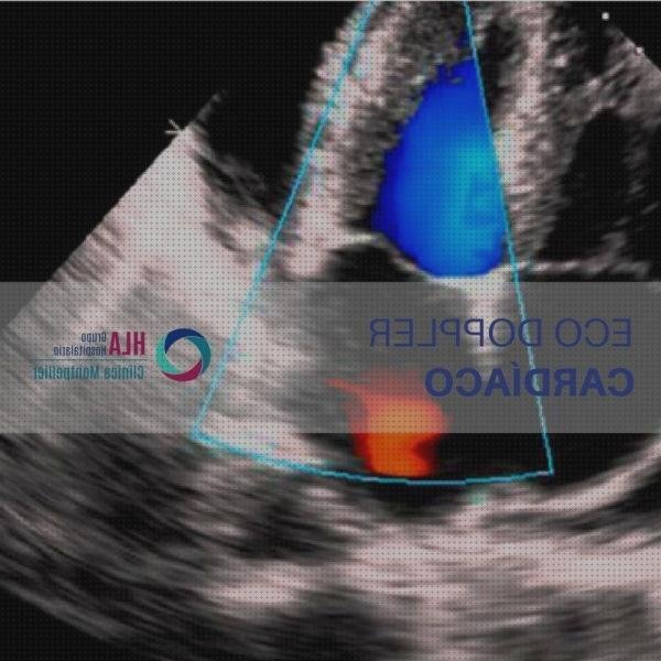 Las mejores eco doppler y holter
