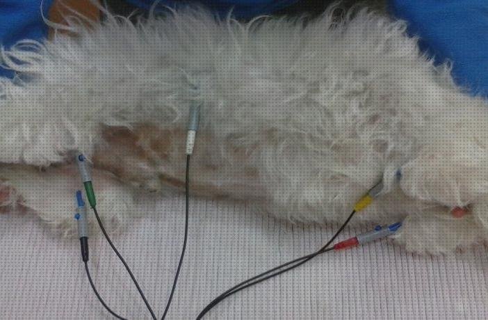 26 Mejores electrocardiografo electros