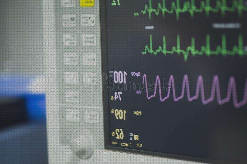 Las mejores marcas de electrocardiografo electrocardiógrafo hospital