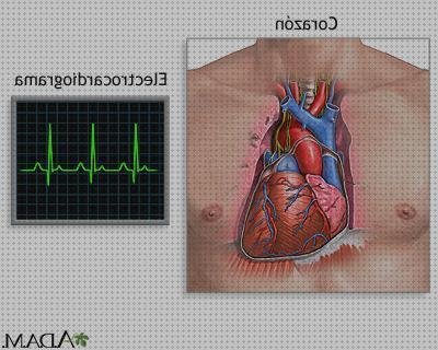 ¿Dónde poder comprar Mas electrocardiografo general electrico precio mac 2000 electrocardiografo electrocardiografo md e?