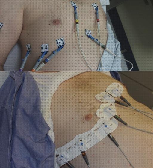 ¿Dónde poder comprar electrodos electrocardiografo y electrodos?