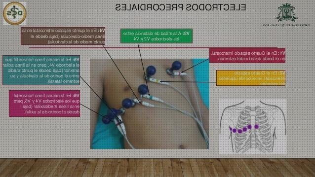 Las mejores electrodos electrocardiografo y electrodos