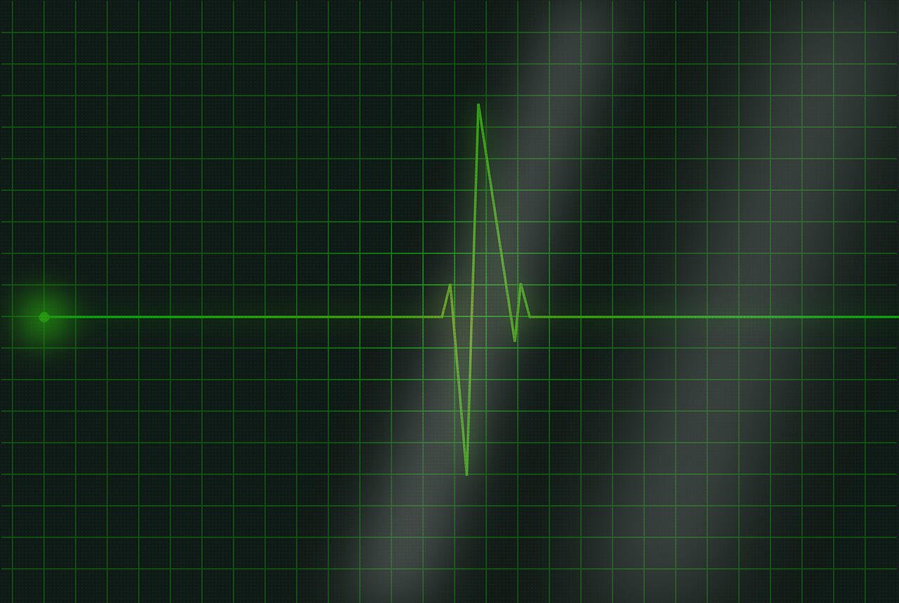 TOP 19 electrocardiograma fonendoscopios