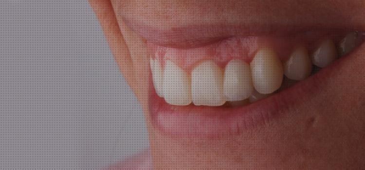 Opiniones de encias encias inflamadas porr el irrigador dental