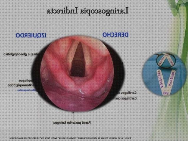¿Dónde poder comprar epiglotis laringoscopio?