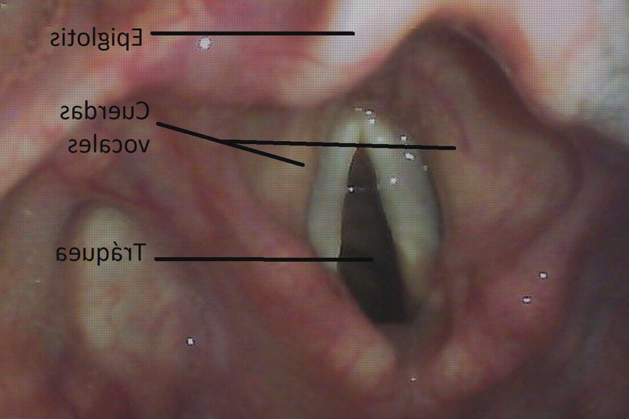 Las mejores epiglotis laringoscopio