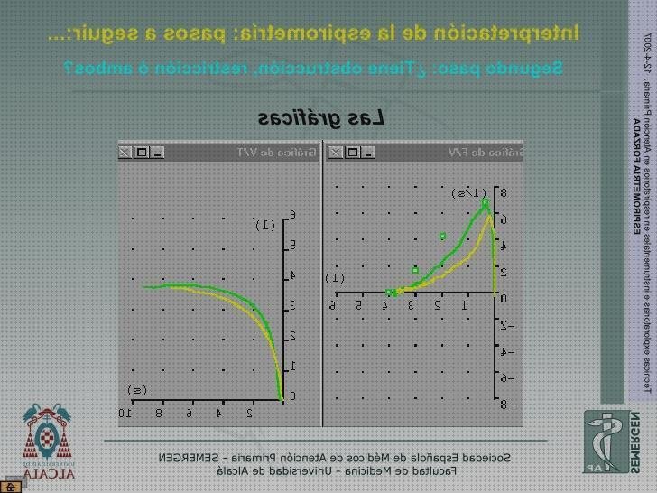 Análisis de los 12 mejores espirometría graficas del mundo