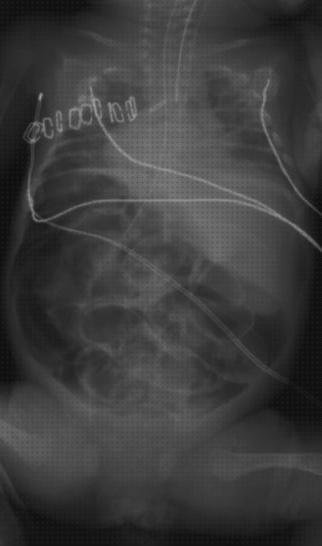 Las mejores marcas de bolas espirometro bolas infladas