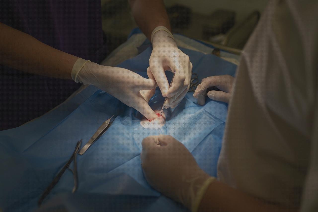 Review de esterilización tijeras quirurgicas