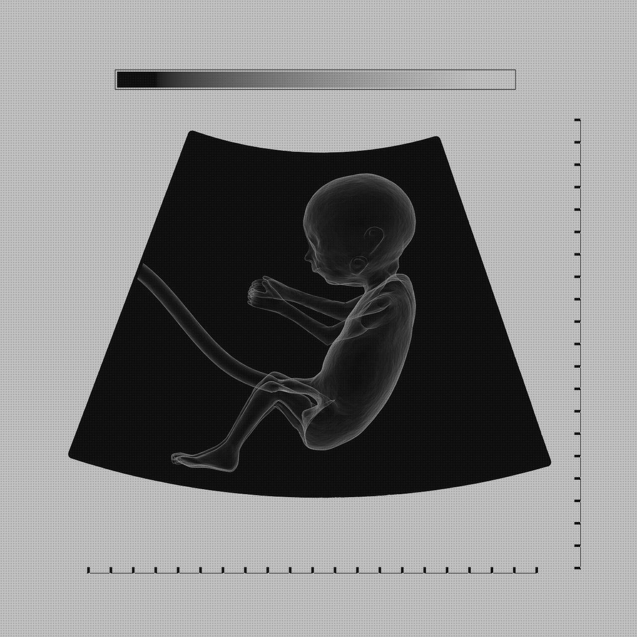 ¿Dónde poder comprar estetoscopios estetoscopio frecuencia cardiaca?