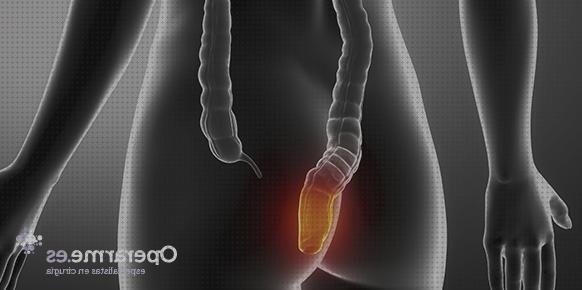 Las mejores operacion bisturi fistula operacion bisturi eléctrico