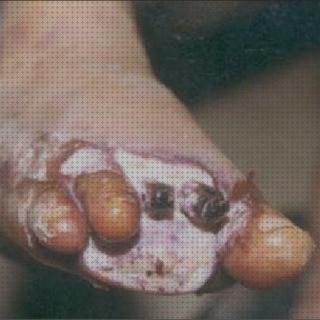 ¿Dónde poder comprar apósitos sergas 2020 Mas apósitos granos Mas apósitos venex fornells garcía blanco y chorat 2020 apósitos?