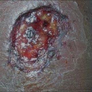 Opiniones de los 2 mejores Fornells García Blancos Y Chorat 2020 Apósitos