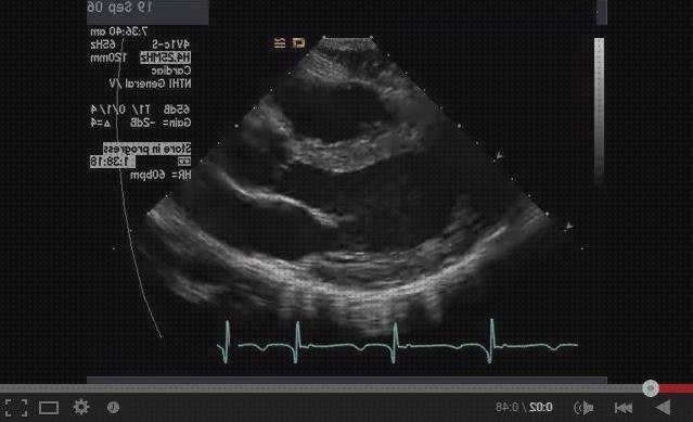 Las mejores marcas de heart eco doppler