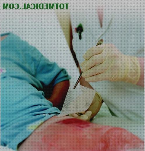 Review de hidrotul apósitos