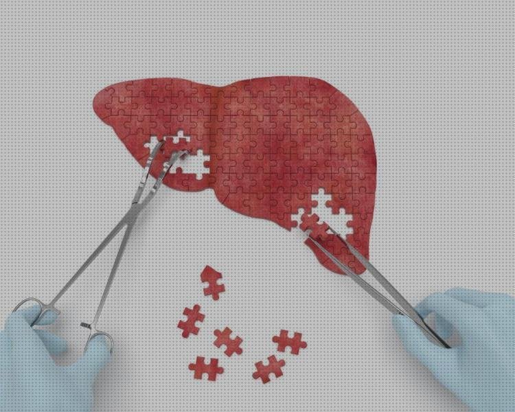 21 Mejores higado médicos